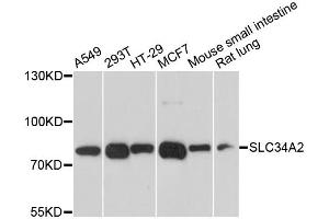Western blot analysis of extracts of various cell lines, using SLC34A2 antibody. (SLC34A2 抗体)
