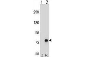 Western blot analysis of TGFBI (arrow) using rabbit polyclonal TGFBI Antibody (N-term) . (TGFBI 抗体  (N-Term))