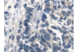 Immunohistochemistry (IHC) image for anti-V-Erb-A erythroblastic Leukemia Viral Oncogene Homolog 4 (Avian) (ERBB4) (AA 29-278) antibody (ABIN7440776)