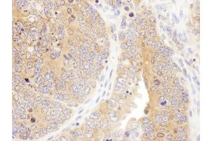 Immunohistochemistry (IHC) image for anti-Septin 7 (SEPT7) (AA 387-437) antibody (ABIN7455012) (Septin 7 抗体  (AA 387-437))