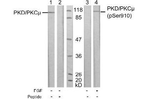 Image no. 1 for anti-Protein Kinase D1 (PRKD1) (pSer910) antibody (ABIN196785) (PKC mu 抗体  (pSer910))