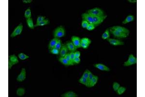 Immunofluorescence staining of HepG2 cells with ABIN7168811 at 1:400, counter-stained with DAPI. (SEMA5A 抗体  (AA 201-400))