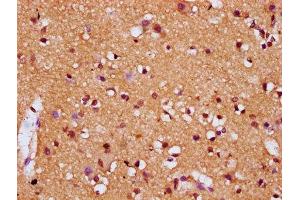 IHC image of ABIN7154582 diluted at 1:200 and staining in paraffin-embedded human brain tissue performed on a Leica BondTM system. (DIRAS1 抗体  (AA 1-195))