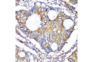 Immunohistochemistry (IHC) image for anti-ARP1 Actin-Related Protein 1 Homolog B, Centractin beta (ACTR1B) (AA 1-105) antibody (ABIN7265675)