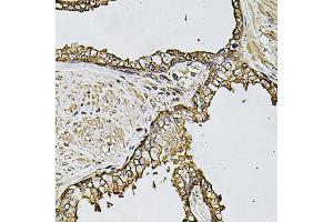 Immunohistochemistry of paraffin-embedded human prostate using CSTB antibody (ABIN5972004) at dilution of 1/100 (40x lens). (CSTB 抗体)