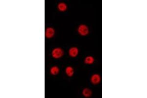 ABIN6278212 staining HepG2 by IF/ICC. (XPO4 抗体  (N-Term))