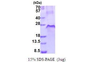 SDS-PAGE (SDS) image for Tumor Necrosis Factor Receptor Superfamily, Member 1A (TNFRSF1A) (AA 22-211) protein (His tag) (ABIN5853971)