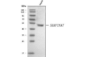 Western blot analysis of Thyroxine Binding Globulin/SERPINA7 using anti-Thyroxine Binding Globulin/SERPINA7 antibody (ABIN7602019). (SERPINA7 抗体  (AA 55-389))