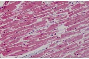 Human Heart: Formalin-Fixed, Paraffin-Embedded (FFPE) (GP1BB 抗体  (AA 56-118))