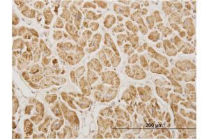Immunoperoxidase of monoclonal antibody to NDUFA5 on formalin-fixed paraffin-embedded human heart. (NDUFA5 抗体  (AA 1-116))