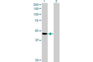 Western Blot analysis of SERPINB2 expression in transfected 293T cell line by SERPINB2 MaxPab polyclonal antibody. (SERPINB2 抗体  (AA 1-415))