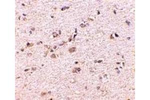 Immunohistochemistry (IHC) image for anti-Discs, Large (Drosophila) Homolog-Associated Protein 1 (DLGAP1) (Middle Region) antibody (ABIN1031076) (DLGAP1 抗体  (Middle Region))
