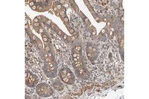 Immunohistochemical staining of human colon with SLC6A7 polyclonal antibody  shows moderate cytoplasmic positivity in glandular cells at 1:20-1:50 dilution. (SLC6A7 抗体)