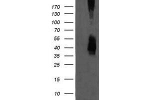 Image no. 1 for anti-Mitogen-Activated Protein Kinase Kinase 3 (MAP2K3) antibody (ABIN1499419) (MAP2K3 抗体)