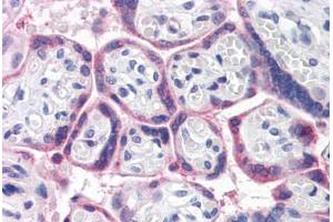 Human Placenta (formalin-fixed, paraffin-embedded) stained with ATG16L1 antibody ABIN351447 at 5 ug/ml followed by biotinylated goat anti-rabbit IgG secondary antibody ABIN481713, alkaline phosphatase-streptavidin and chromogen. (ATG16L1 抗体  (Internal Region))