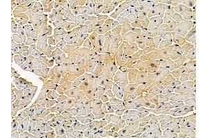 ABIN7094451 and ABIN7098499 at 1/100 staining mouse heart tissue by IHC-P.