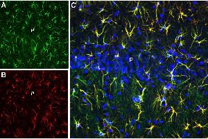 Multiplex staining of CLEC7A and GFAP in rat hippocampal CA1 regionImmunohistochemical staining of perfusion-fixed frozen rat brain sections with Anti-CLEC7A/Dectin-1 (extracellular) Antibody (ABIN7237603, ABIN7316623 and ABIN7316624), (1:600), followed by goat anti-rabbit-AlexaFluor-488 and Guinea Pig Anti-GFAP Antibody (ABIN7237688, ABIN7316585 and ABIN7316586), (1:600), followed by goat anti-guinea pig-AlexaFluor-594.