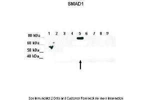 Lanes:   Lane 1: 5ug of transfected 293T lysate (SMAD1)  Lane 1: 5ug of transfected 293T lysate (SMAD2)  Lane 1: 5ug of transfected 293T lysate (SMAD3)  Lane 1: 5ug of transfected 293T lysate (SMAD4)  Lane 1: 5ug of transfected 293T lysate (SMAD5)  Lane 1: 5ug of transfected 293T lysate (SMAD6)  Lane 1: 5ug of transfected 293T lysate (SMAD7)  Lane 1: 5ug of transfected 293T lysate (SMAD8)  Lane 1: 5ug of transfected 293T lysate (GFP)  Primary Antibody Dilution:   1:1000  Secondary Antibody:   Goat anti-Rabbit IgG HRP Conjugated  Secondary Antibody Dilution:   1:10,000  Gene Name:   SMAD5  Submitted by:   Amanda Urick, Medical College of Wisconsin (SMAD5 抗体  (Middle Region))