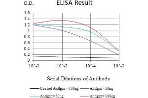Black line: Control Antigen (100 ng),Purple line: Antigen (10 ng), Blue line: Antigen (50 ng), Red line:Antigen (100 ng) (ACSS1 抗体  (AA 548-689))