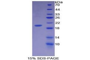SDS-PAGE analysis of Mouse GDF7 Protein. (GDF7 蛋白)