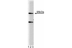 Western blot analysis of Villin on HCT-8 lysate. (Villin 1 抗体  (AA 1-827))