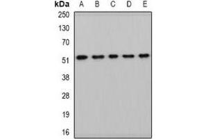 Western blot analysis of HARS2 expression in HepG2 (A), mouse kidney (B), mouse heart (C), rat liver (D), rat brain (E) whole cell lysates. (HARS2 抗体)
