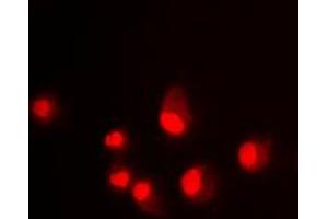 Immunofluorescent analysis of MDM2 staining in Jurkat cells. (MDM2 抗体  (C-Term))