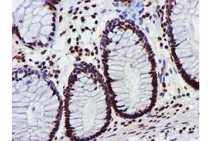 Image no. 9 for anti-Glutathione S-Transferase theta 2 (GSTT2) antibody (ABIN1498553) (GSTT2 抗体)