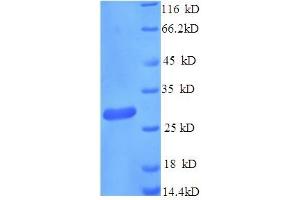SDS-PAGE (SDS) image for Cathepsin K (CTSK) (AA 115-329) protein (His tag) (ABIN5709363)