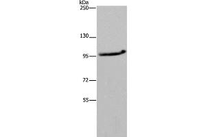 Western Blot analysis of LO2 cell using MAP3K11 Polyclonal Antibody at dilution of 1:400 (MAP3K11 抗体)