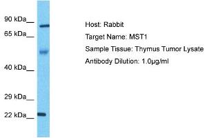 Host: Rabbit Target Name: MST1 Sample Type: Thymus Tumor lysates Antibody Dilution: 1. (MST1 抗体  (N-Term))