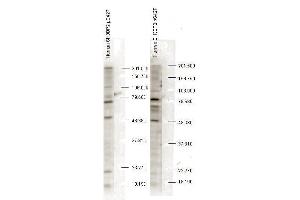 Western blot analysis is shown using anti-SH3BP2 pS427 antibody to detect endogenous protein present in unstimulated human whole cell lysates). (SH3BP2 抗体  (pSer427))