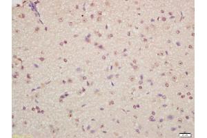 Formalin-fixed and paraffin embedded mouse brain labeled with Anti-Musashi 1/Msi1 Polyclonal Antibody, Unconjugated (ABIN1387744) at 1:200 followed by conjugation to the secondary antibody and DAB staining (Musashi 1/2 (AA 66-150) 抗体)
