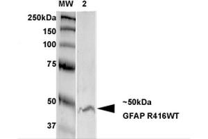Western Blot analysis of Rat Brain Membrane showing detection of GFAP protein using Mouse Anti-GFAP Monoclonal Antibody, Clone S206B-9 . (GFAP 抗体  (AA 411-422) (HRP))