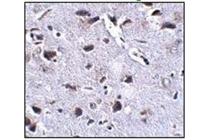 Immunohistochemistry of RCAN2 in mouse brain tissue with this product at 2. (RCAN2 抗体  (Center))