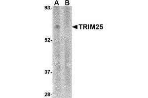Western blot analysis of TRIM25 in human thymus tissue lysate in (A) the absence and (B) presence of blocking peptide with this product at 1 μg/ml. (TRIM25 抗体  (N-Term))