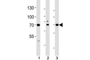 Western Blotting (WB) image for anti-Activating Transcription Factor 6 beta (ATF6B) (AA 560-589) antibody (ABIN3029852)