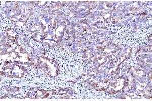 IHC analysis of Poliovirus Receptor/PVR using anti-Poliovirus Receptor/PVR antibody (ABIN7601071).