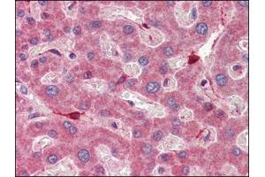 Human Liver (formalin-fixed, paraffin-embedded) stained with RBP1followed by biotinylated anti-goat IgG secondary antibody, alkaline phosphatase-streptavidin and chromogen. (RBP1 抗体  (C-Term))