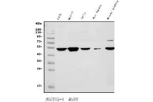 Western blot analysis of RGS6 using anti-RGS6 antibody (ABIN7602326).