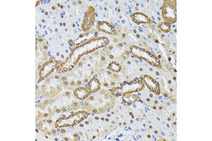 Immunohistochemistry of paraffin-embedded mouse kidney using SMN1 antibody (ABIN7270652) at dilution of 1:100 (40x lens). (SMN1 抗体  (AA 80-150))