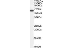 Western Blotting (WB) image for anti-Family with Sequence Similarity 107, Member A (FAM107A) (N-Term) antibody (ABIN2156803) (FAM107A 抗体  (N-Term))