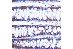Immunohistochemistry of paraffin-embedded Human colon using TOP1MT Rabbit pAb (ABIN7270851) at dilution of 1:100 (40x lens). (TOP1MT 抗体  (AA 470-550))
