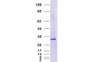 Validation with Western Blot