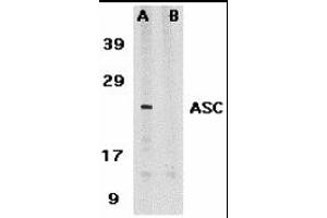Western Blotting (WB) image for anti-Steroid Sulfatase (STS) antibody (ABIN1031704)