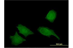 Immunofluorescence of monoclonal antibody to IREB2 on HeLa cell. (IREB2 抗体  (AA 1-343))