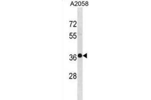 Western Blotting (WB) image for anti-TruB Pseudouridine (Psi) Synthase Homolog 2 (TRUB2) antibody (ABIN3001393) (TRUB2 抗体)