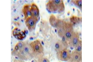IHC-P analysis of Liver tissue, with DAB staining. (PNPLA2 抗体  (AA 481-702))