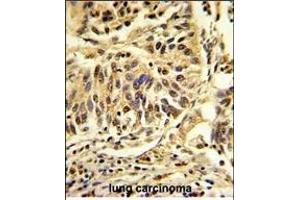 Immunohistochemistry (Paraffin-embedded Sections) (IHC (p)) image for anti-CCAAT/enhancer Binding Protein (C/EBP), beta (CEBPB) (AA 271-298), (C-Term) antibody (ABIN652248)