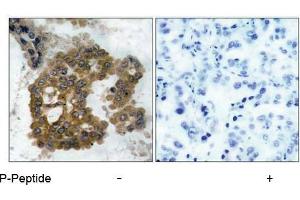 Image no. 1 for anti-V-Akt Murine Thymoma Viral Oncogene Homolog 2 (AKT2) (pSer474) antibody (ABIN196826) (AKT2 抗体  (pSer474))